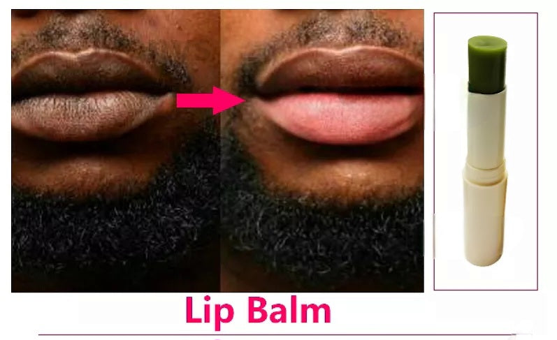 Lip Lightening Balm